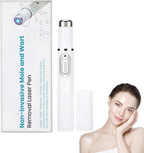Non-Invasive Mole and Wart Removal Laser Pen